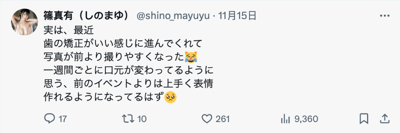 矫正牙齿中！史上最强隐藏大白兔、最细JCup的她要变性感女神？-图片4