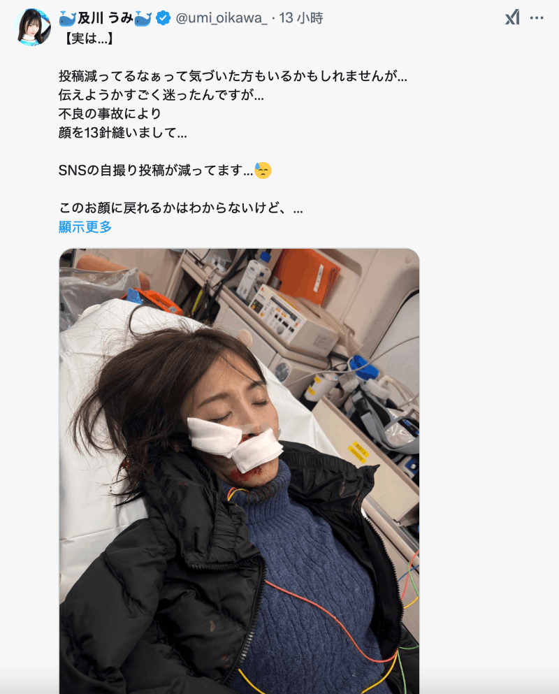 社群发文变少……原来及川うみ(及川海)出大事了！-图片2